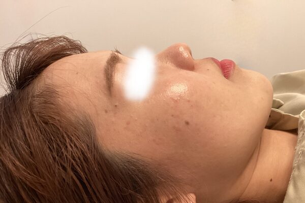 After