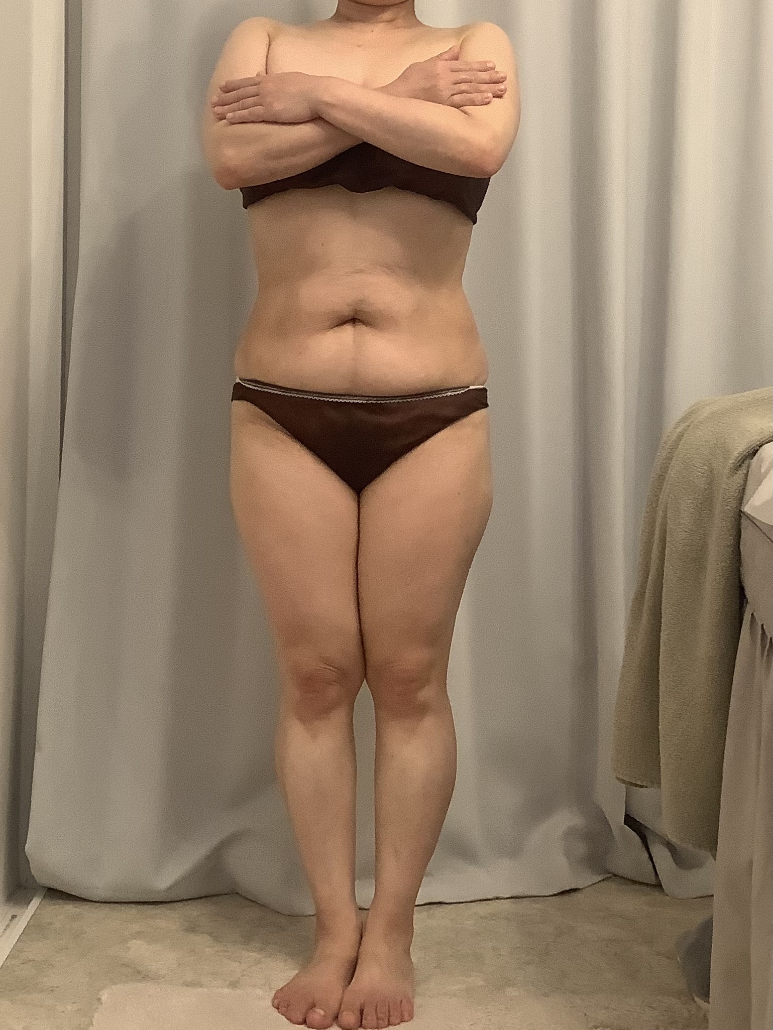 広島・安佐南区の痩身ダイエット最新事例：3ヶ月目のアフター写真（Luana＋）