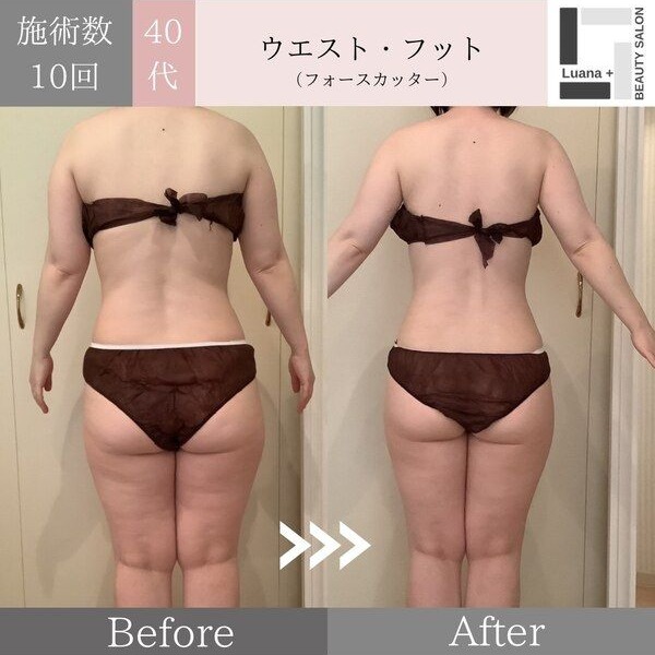 広島・安佐南区の痩身ダイエット事例：継続した結果